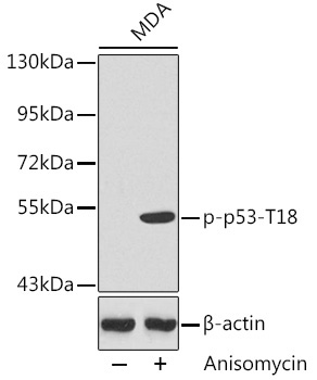 Phospho-p53-T18 Rabbit Polyclonal Antibody