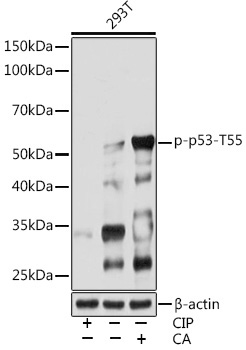 Phospho-p53-T55 Rabbit Monoclonal Antibody