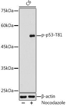 Phospho-p53-T81  Rabbit Polyclonal Antibody