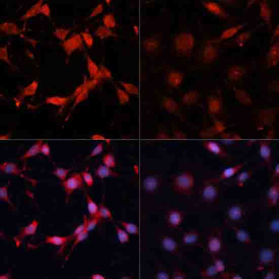 Phospho-p70 S6 Kinase 1-T389 Rabbit Polyclonal Antibody - Image 2
