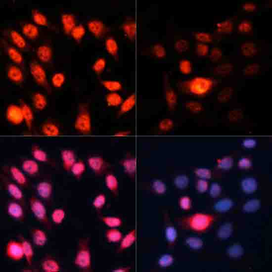 Phospho-p70 S6 Kinase 1-T389 Rabbit Polyclonal Antibody - Image 3