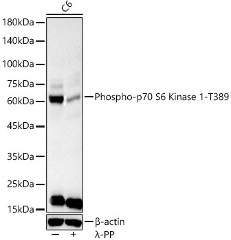 Phospho-p70 S6 Kinase 1-T389 Rabbit Polyclonal Antibody - Image 2