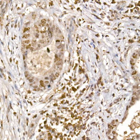 Phospho-p70 S6 Kinase 1-T389 Rabbit Polyclonal Antibody - Image 3