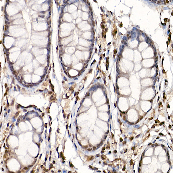 Phospho-p70 S6 Kinase 1-T389 Rabbit Polyclonal Antibody - Image 4