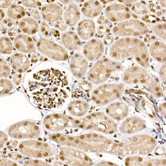 Phospho-p70 S6 Kinase 1-T389 Rabbit Polyclonal Antibody - Image 5