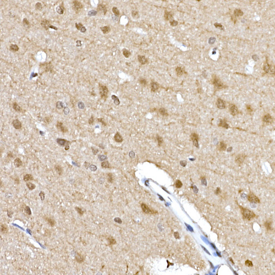Phospho-p70 S6 Kinase 1-T389 Rabbit Polyclonal Antibody - Image 6