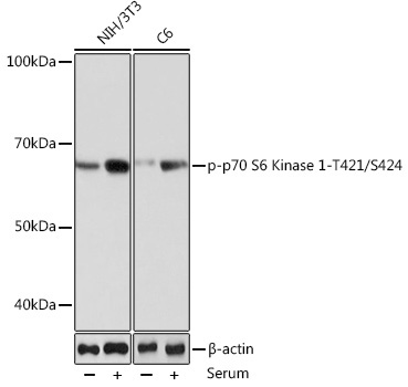 Phospho-p70 S6 Kinase 1-T421/S424 Rabbit Monoclonal Antibody