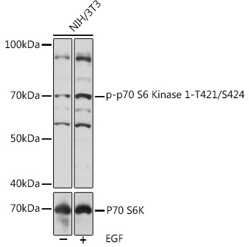 Phospho-p70 S6 Kinase 1-T421/S424 Rabbit Polyclonal Antibody
