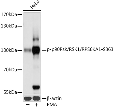 Phospho-p90Rsk/RSK1/RPS6KA1-S363 Rabbit Polyclonal Antibody