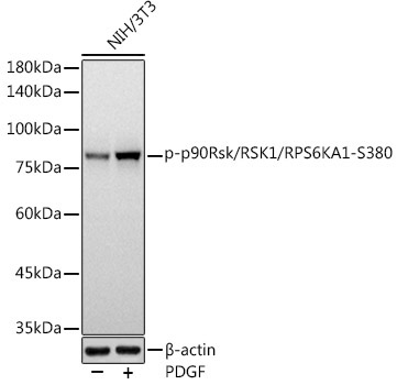 Phospho-p90Rsk/RSK1/RPS6KA1-S380 Rabbit Monoclonal Antibody
