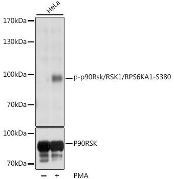 Phospho-p90Rsk/RSK1/RPS6KA1-S380 Rabbit Polyclonal Antibody
