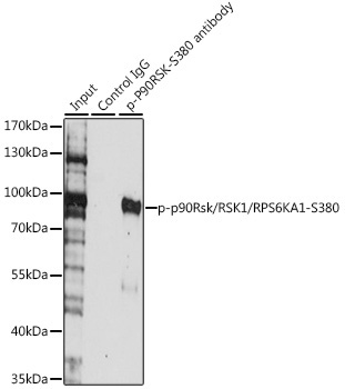 Phospho-p90Rsk/RSK1/RPS6KA1-S380 Rabbit Polyclonal Antibody - Image 3