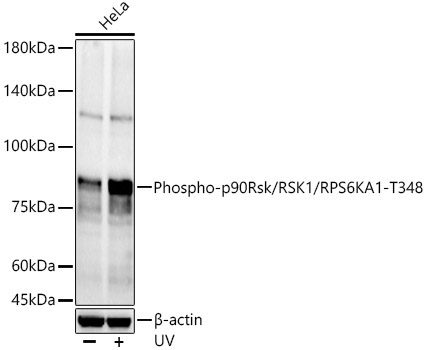 Phospho-p90Rsk/RSK1/RPS6KA1-T348 Rabbit Polyclonal Antibody