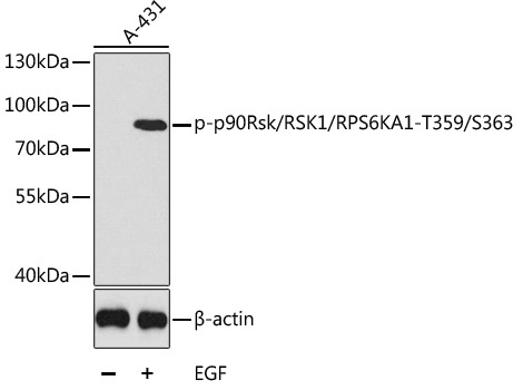 Phospho-p90Rsk/RSK1/RPS6KA1-T359/S363 Rabbit Polyclonal Antibody