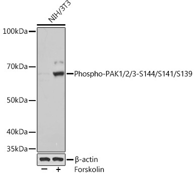 Phospho-PAK1/2/3-S144/S141/S139 Rabbit Monoclonal Antibody