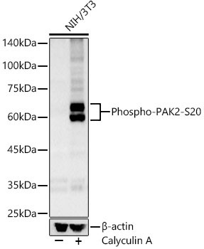 Phospho-PAK2-S20 Rabbit Polyclonal Antibody