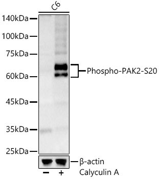 Phospho-PAK2-S20 Rabbit Polyclonal Antibody - Image 2