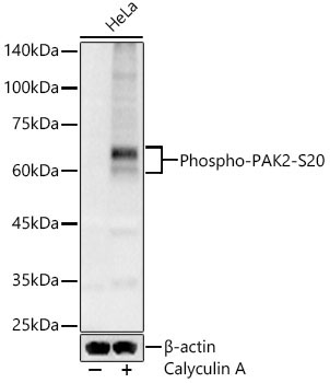 Phospho-PAK2-S20 Rabbit Polyclonal Antibody - Image 3