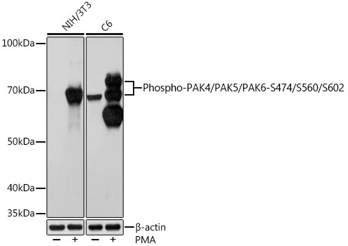 Phospho-PAK4/PAK5/PAK6-S474/S560/S602 Rabbit Monoclonal Antibody