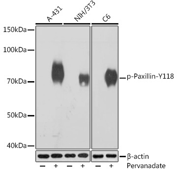 Phospho-Paxillin-Y118 Rabbit Monoclonal Antibody