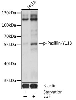 Phospho-Paxillin-Y118 Rabbit Polyclonal Antibody