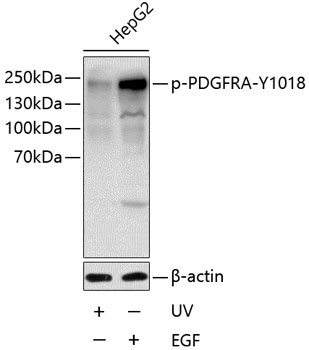 Phospho-PDGFR alpha-Y1018 Rabbit Polyclonal Antibody