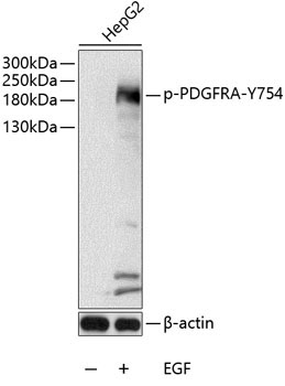 Phospho-PDGFR alpha-Y754 Rabbit Polyclonal Antibody