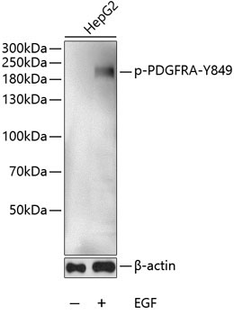 Phospho-PDGFR alpha-Y849 Rabbit Polyclonal Antibody