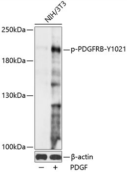 Phospho-PDGFRB-Y1021 Rabbit Polyclonal Antibody