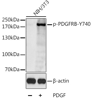 Phospho-PDGFRB-Y740 Rabbit Polyclonal Antibody