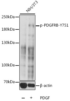 Phospho-PDGFRB-Y751 Rabbit Polyclonal Antibody