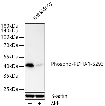Phospho-PDHA1-S293 Rabbit Monoclonal Antibody - Image 3