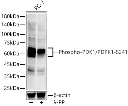 Phospho-PDK1/PDPK1-S241 Rabbit Monoclonal Antibody
