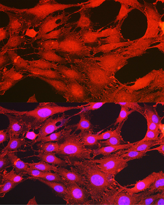 Phospho-PDK1/PDPK1-S241 Rabbit Polyclonal Antibody - Image 2