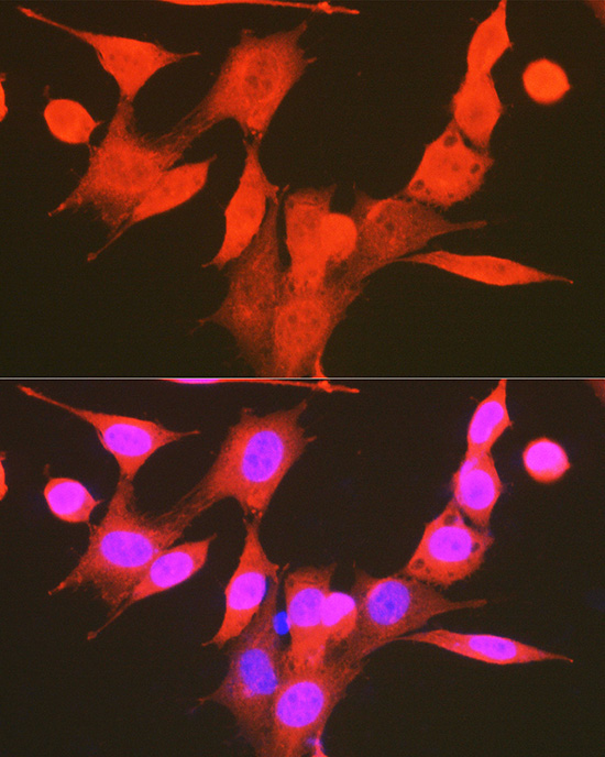 Phospho-PDK1/PDPK1-S241 Rabbit Polyclonal Antibody - Image 3