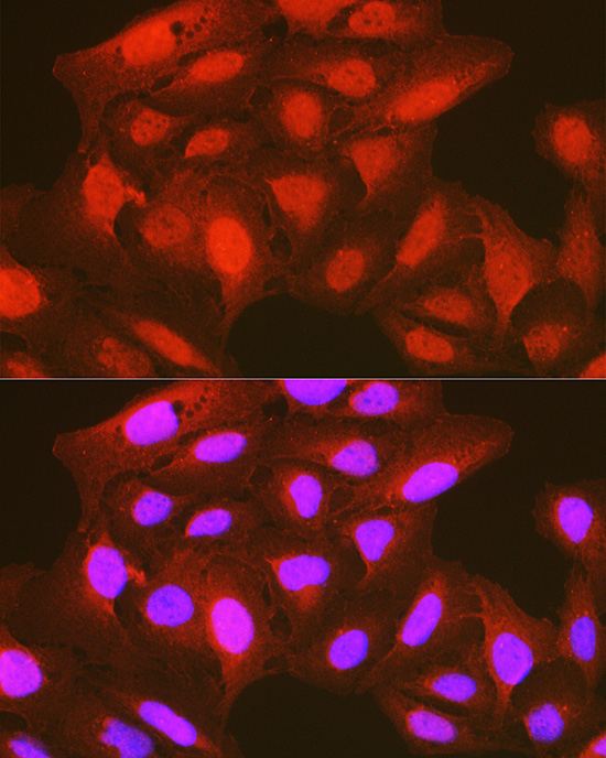 Phospho-PDK1/PDPK1-S241 Rabbit Polyclonal Antibody - Image 4