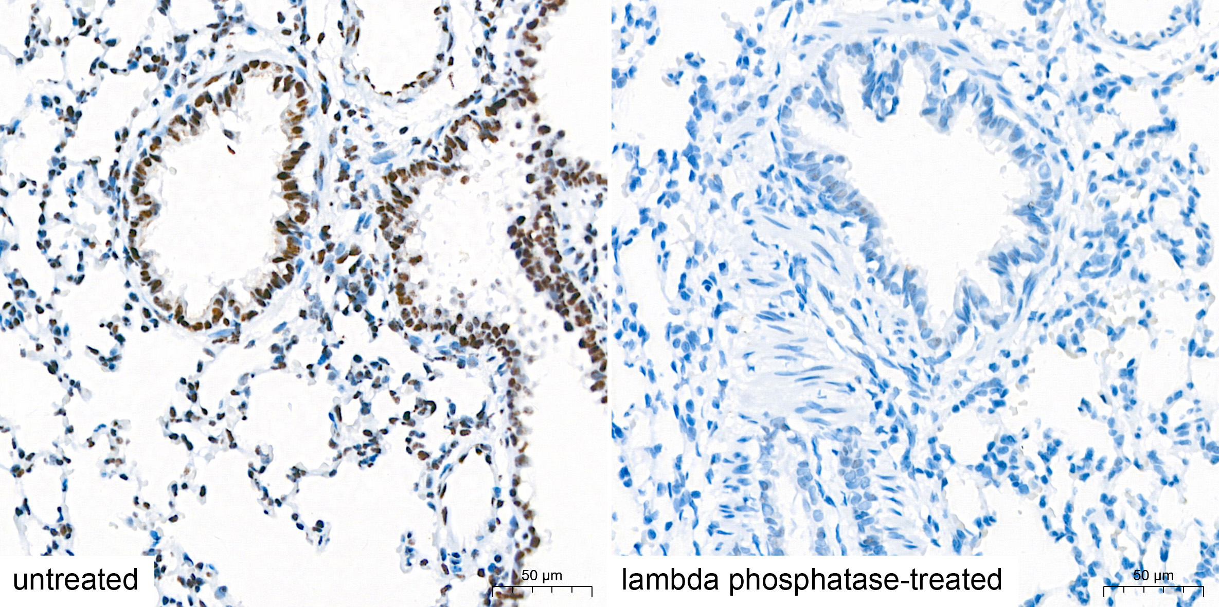 Phospho-PERK-T982 Rabbit Monoclonal Antibody