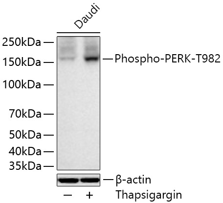 Phospho-PERK-T982 Rabbit Polyclonal Antibody