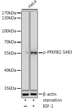 Phospho-PFKFB2-S483 Rabbit Polyclonal Antibody