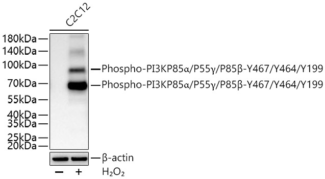 Phospho-PI3KP85Alpha/P55Gamma/P85Beta-Y467/Y464/Y199 Rabbit Polyclonal Antibody