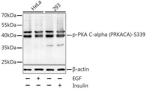 Phospho-PKA C-alpha (PRKACA)-S339 Rabbit Polyclonal Antibody