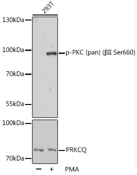 Phospho-PKC (pan) (BetaII Ser660) Rabbit Polyclonal Antibody