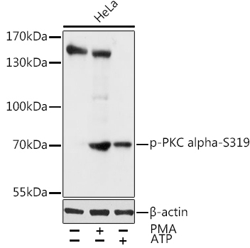 Phospho-PKC alpha-S319 Rabbit Polyclonal Antibody