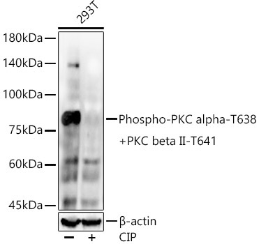 Phospho-PKC alpha-T638 + PKC beta II-T641 Rabbit Monoclonal Antibody