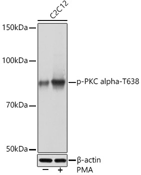Phospho-PKC alpha-T638 Rabbit Monoclonal Antibody