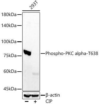 Phospho-PKC alpha-T638 Rabbit Monoclonal Antibody