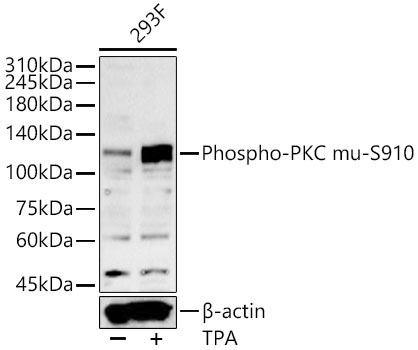 Phospho-PKC mu-S910 Rabbit Polyclonal Antibody