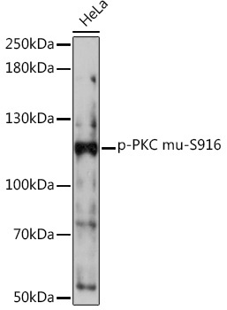 Phospho-PKC mu-S916 Rabbit Polyclonal Antibody