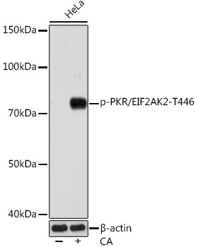Phospho-PKR/EIF2AK2-T446 Rabbit Monoclonal Antibody