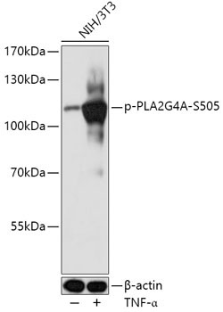 Phospho-PLA2G4A-S505 Rabbit Polyclonal Antibody